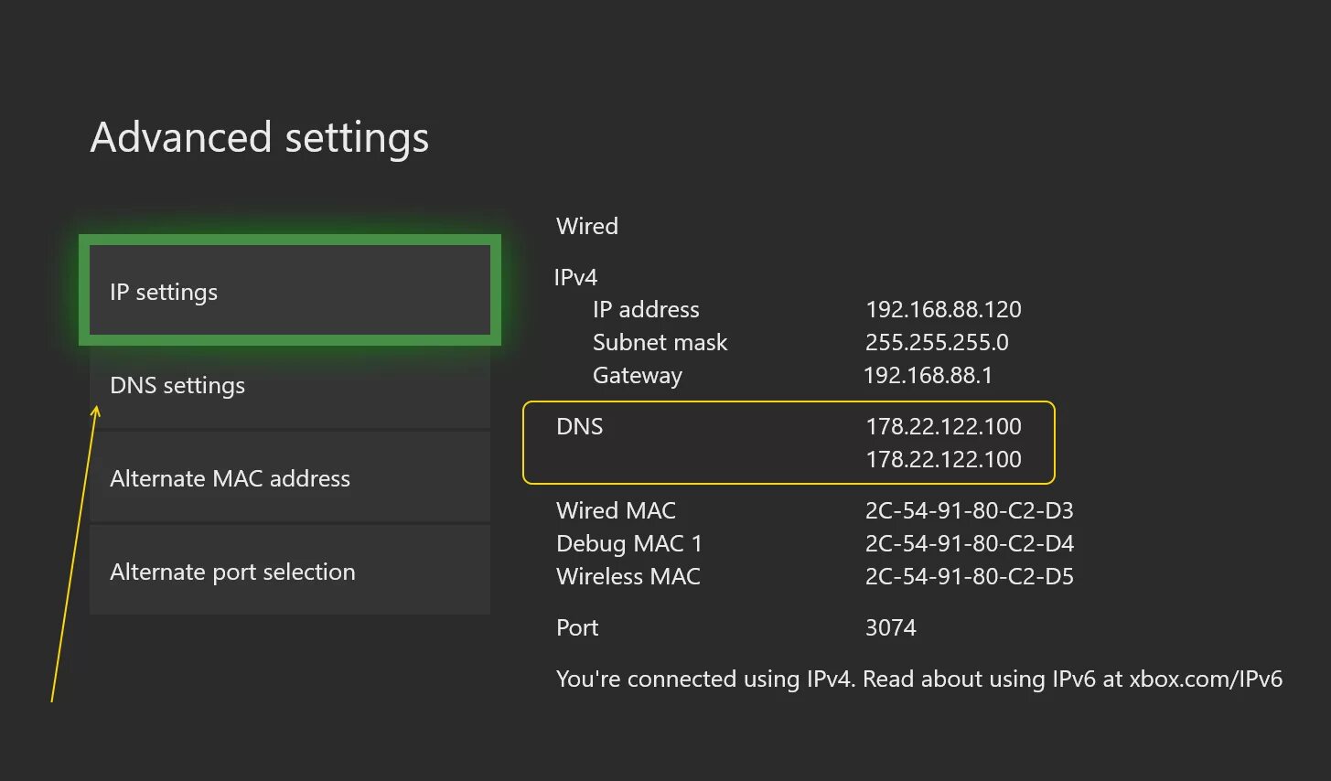 Сервер хбокс. Ipv6 Xbox Series x. Xbox one s DNS. DNS для Xbox. Xbox DNS сервер.