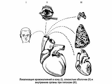 Асфиксия судебная