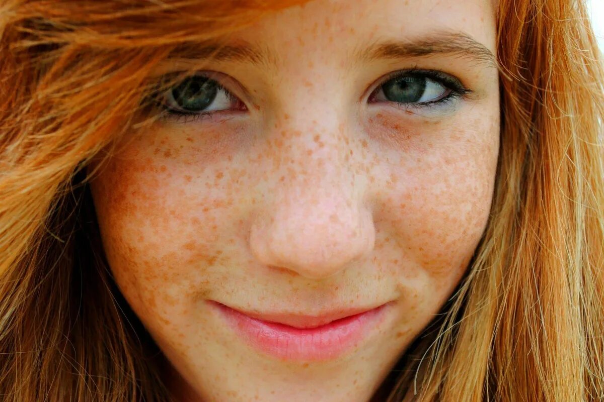Freckles girl