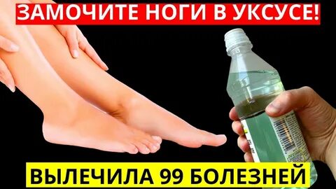 Уксус от грибка на ногах