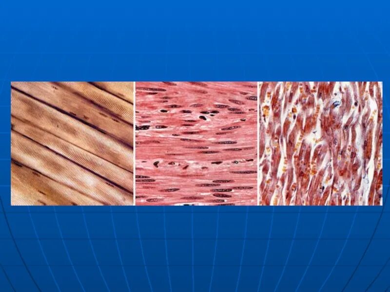 Строение клетки поперечно полосатой мышечной ткани. Поперечно полосатая мышечная ткань микрофотография. Строение мышечной ткани. Поперечно полосатые мышцы и гладкие мышцы. Гладкая ткань человека.