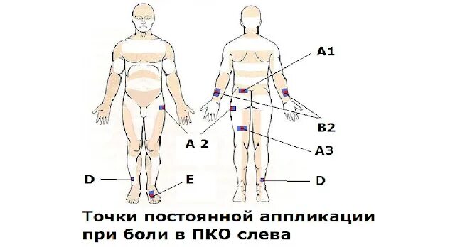 Схема зоны аппликации аппликатором Ляпко. Аппликатор Ляпко при болях в пояснице. Аппликатор Ляпко при радикулопатии. Аппликация при боли в пояснице.