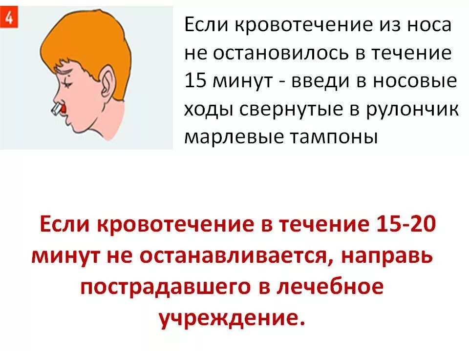 Остановить кровотечение из носа. При кровотечении из носа. Как Остановить носовое кровотечение. Остановка кровотечения из носа. Ребенок 7 лет идет кровь из носа