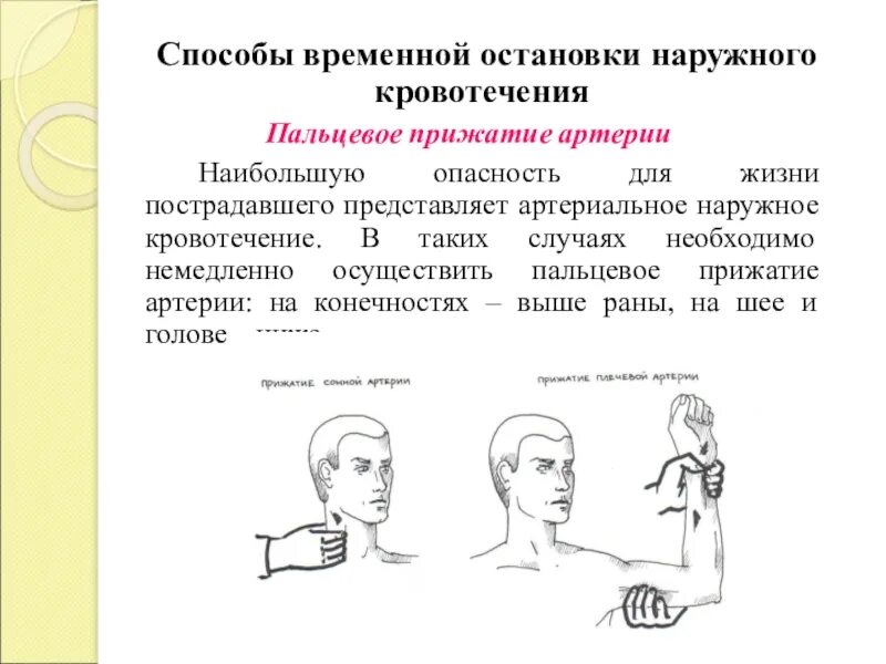 Способы остановки кровотечения пальцевое прижатие артерии. Способы временной остановки наружных кровотечений. Способы временной остановки кровотечения пальцевое прижатие. Временная остановка кровотечения методом пальцевого прижатия. Способы временной остановки кровотечения из сонной артерии.