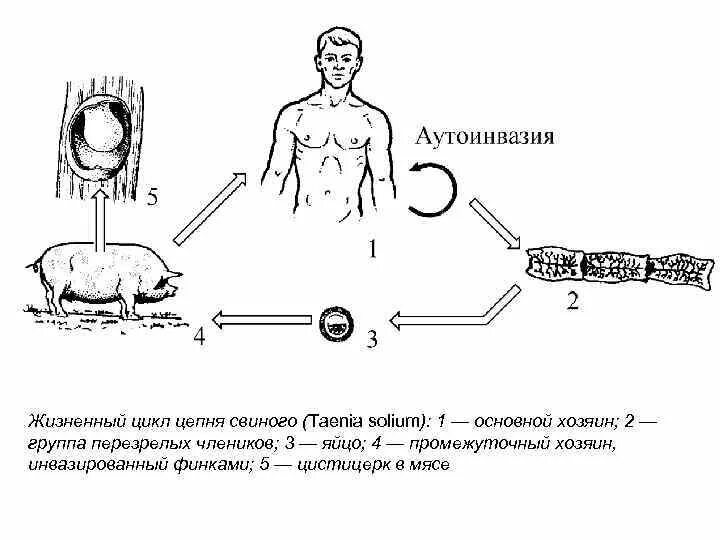 Какая стадия свиного цепня разовьется. Жизненный цикл свиной цепень схема. Жизненный цикл свиного цепня. Жизненный цикл свиного солитера схема. Цикл развития свиного солитера схема.