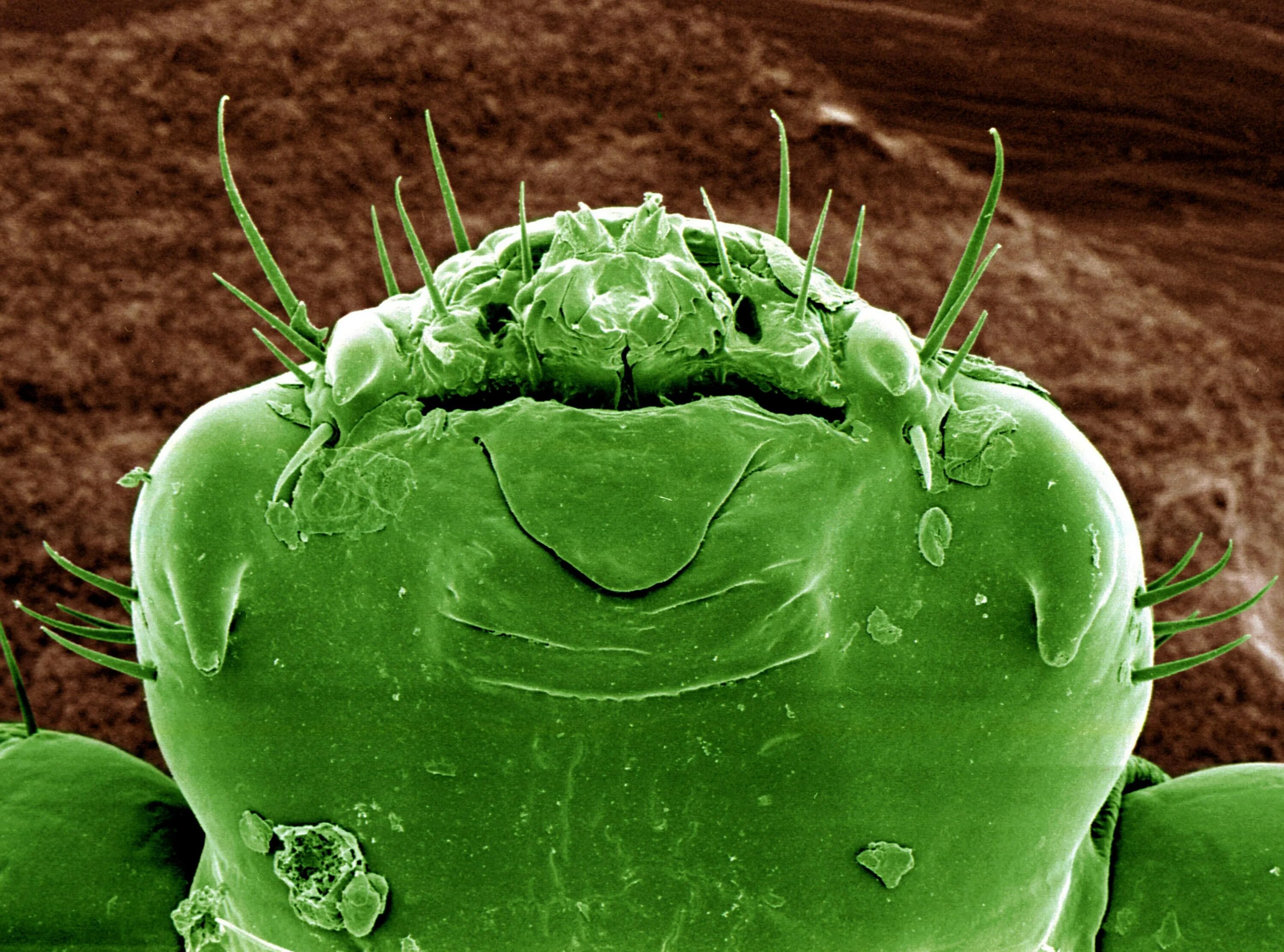 Бактерии клещей. Бактерии под микроскопом для детей. Микробы на коже под микроскопом. Микробы на зубах под микроскопом.