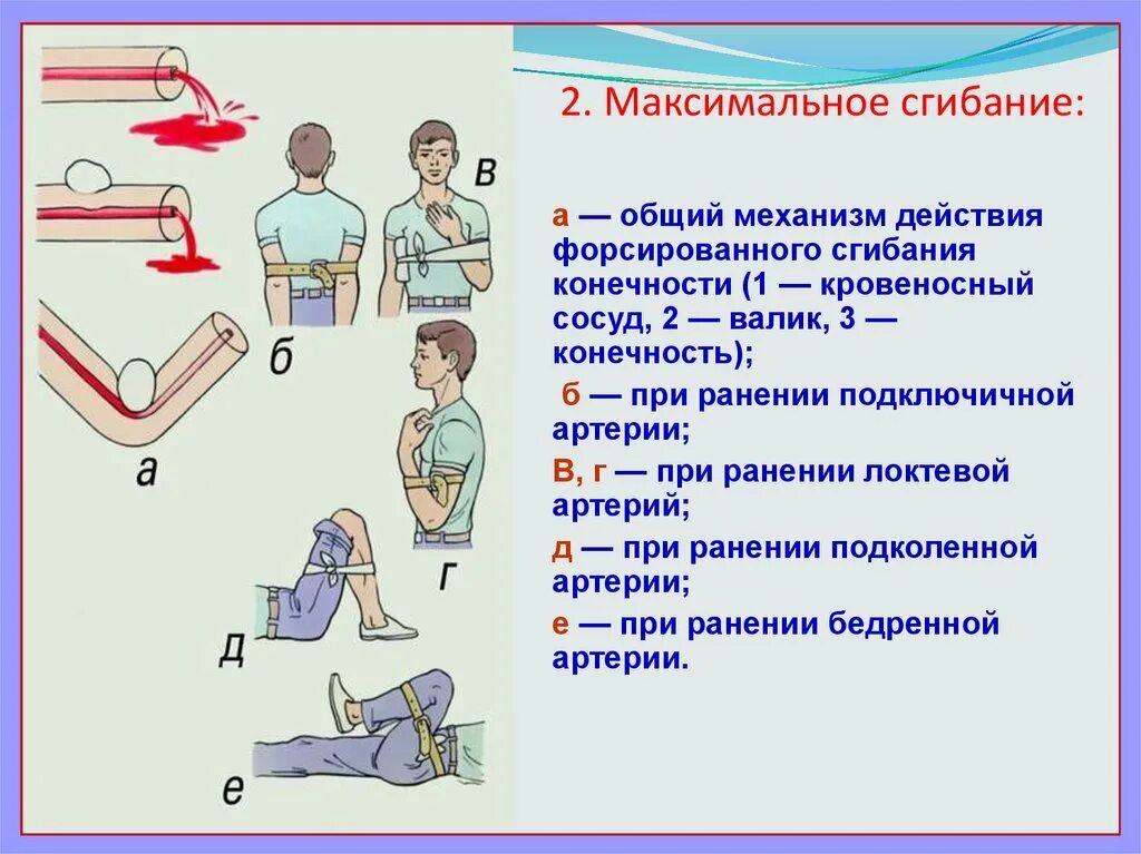 Максимальное сгибание конечности механизм действия. Оказание первой помощи при ранении конечностей. Первая помощь при ЧС. Форсирование сгибания конечности. Этапы первой помощи при ранениях