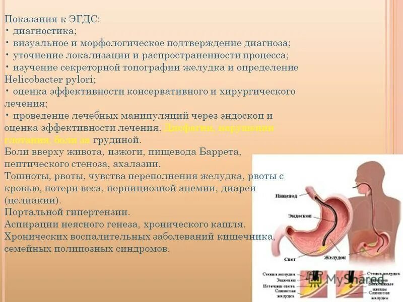хеликобактер ассоциированные заболевания. в желудке хилактобактерии у взрослых. гастрит бактерия helicobacter симптомы. в желудке хилактобактерии у взрослых. в желудке хилактобактерии у взрослых.