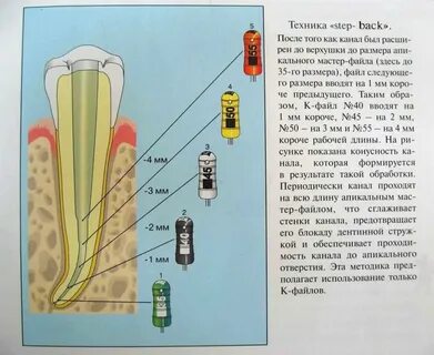 Апикальный упор