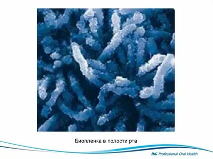 Биопленка полости рта