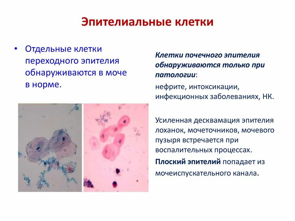 Отсутствуют клетки с признаками атипии. Плоский эпителий цитология. Цилиндрический эпителий цитология. Клетки переходного эпителия в моче. Клетки плоского эпителия 3.