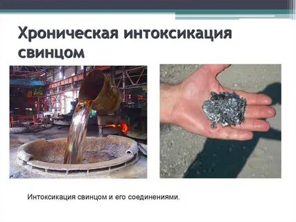Отравление свинцов