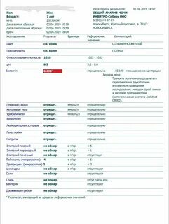 Белок в моче 0 150