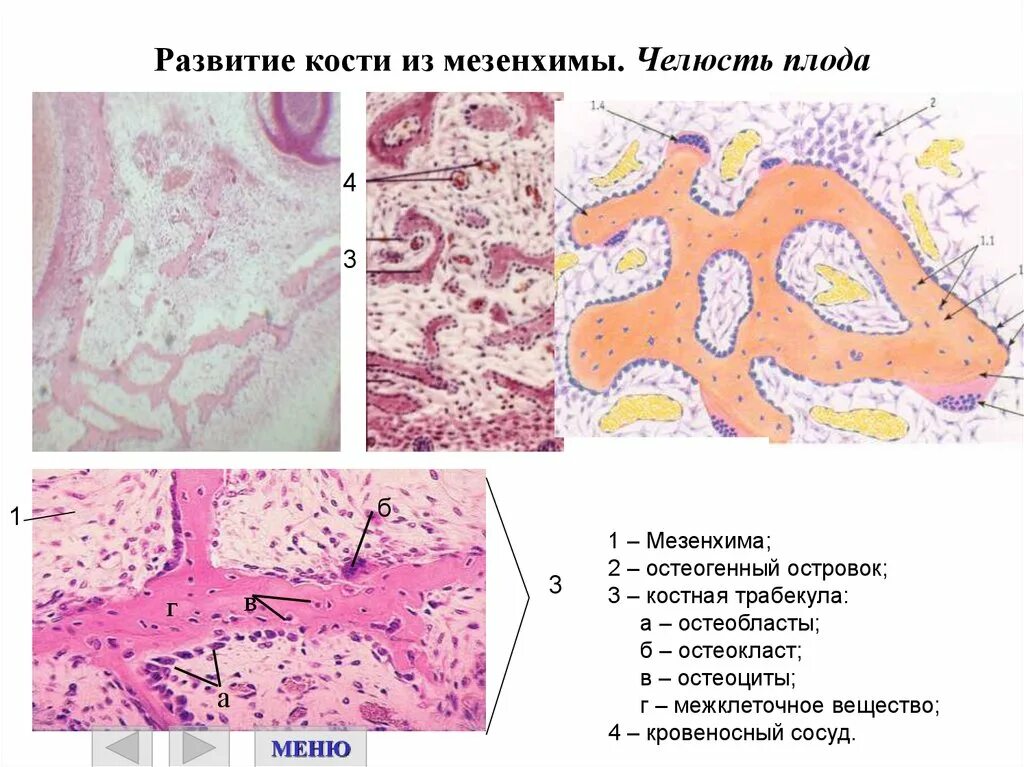 Гистология челюстей. Развитие кости из мезенхимы прямой остеогенез остеогенный островок. развитие кости из мезенхимы препарат гистология рисунок. развитие кости из соединительной ткани (мезенхимы). развитие кости из мезенхимы прямой остеогенез препарат гистология.