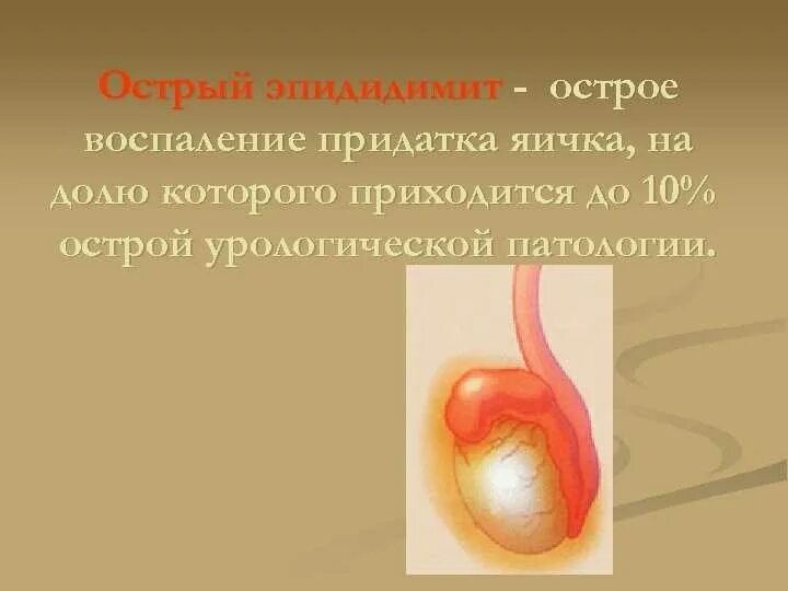 Воспаление придатков у мужчин симптомы и лечение