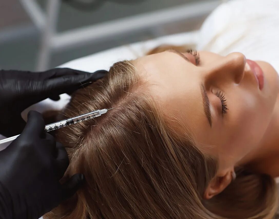 Мезотерапия для волос. Мезо для волос. Мезотерапия для волос. Плазмолифтинг волосистой части головы. Что такое мезотерапия для волос.