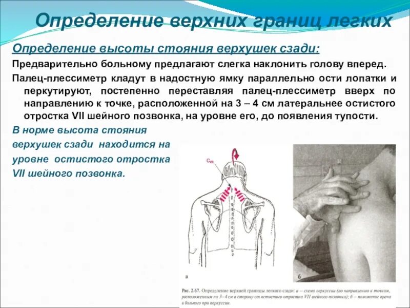 Определение верхней границы легких спереди. Перкуссия верхней границы легких спереди. Стояние верхушек легких норма