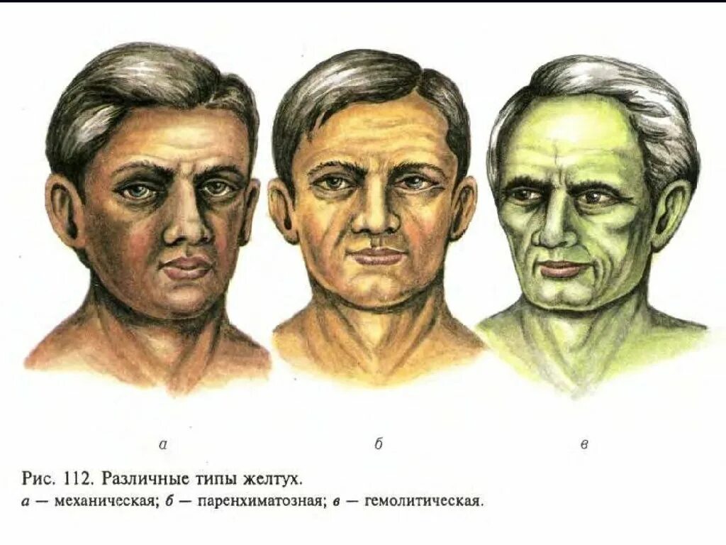 Зеленое лицо причины