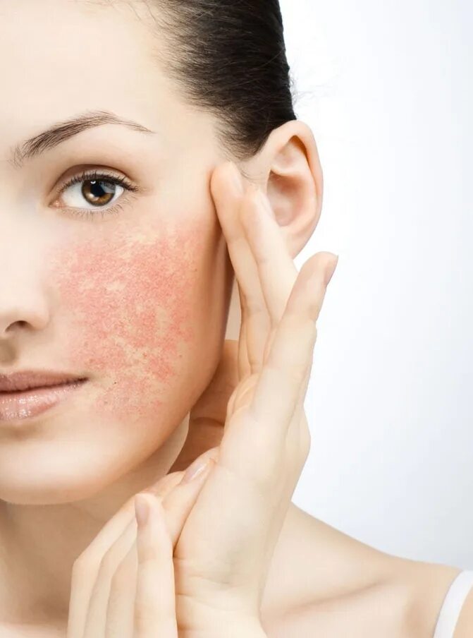 Маска из кожи. Отбеливающие маски для лица. Раздражение на лице маска. Раздражение на лице маска. Чувствительная кожа.