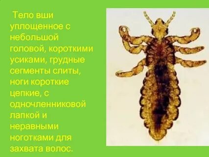 Что означает вша