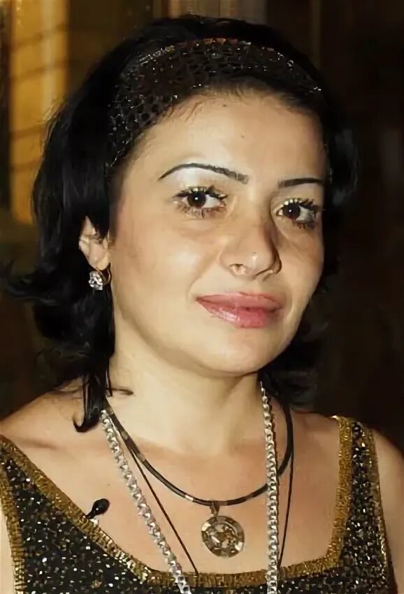 Зулия раджабова до и после пластики Зулия раджабова до и после пластики фото