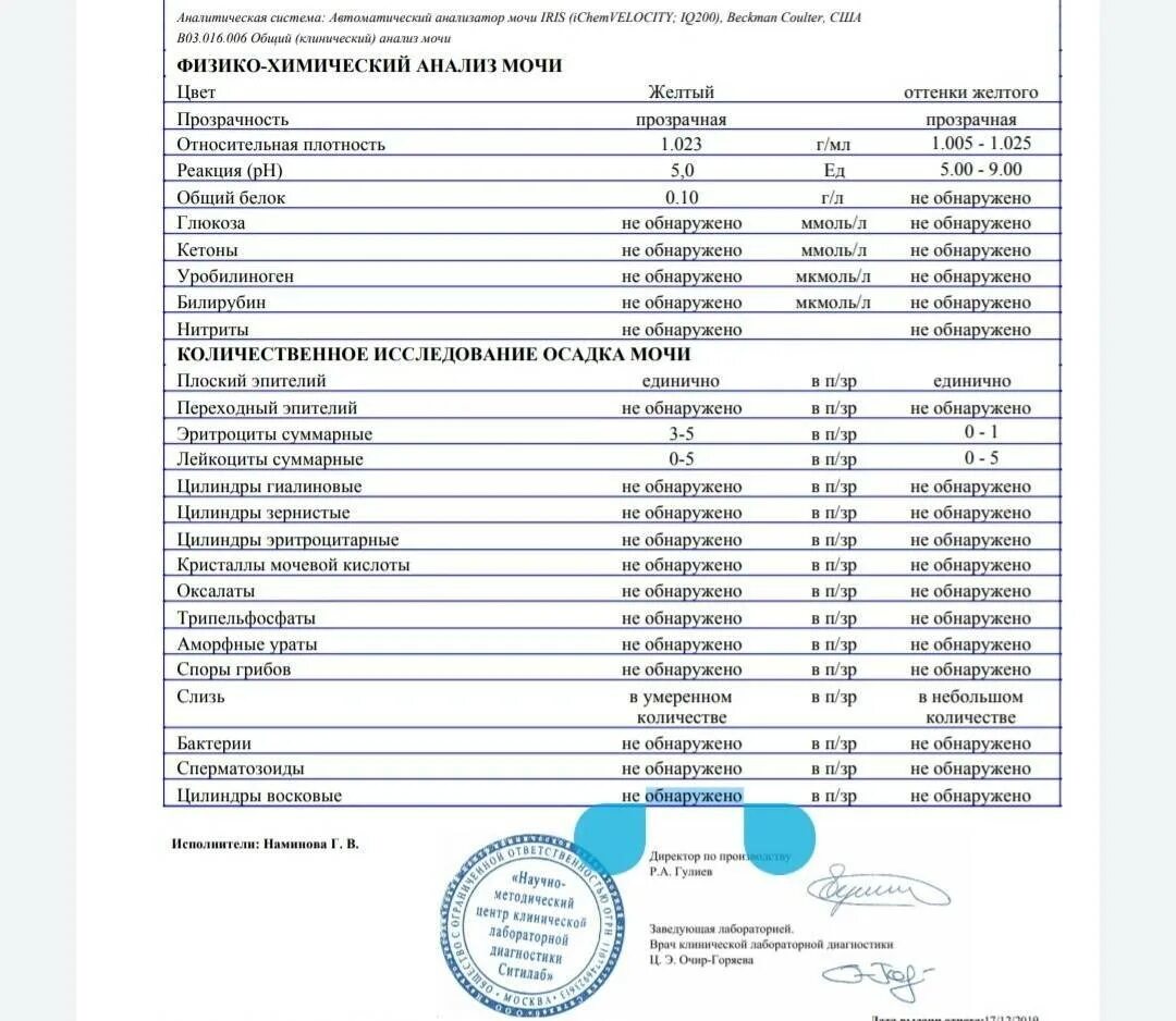 Повышена аскорбиновая кислота в моче. ОАМ норма ацетон. Ацетон в моче норма. Ацетон в моче показатели. Исследование мочи на ацетон.