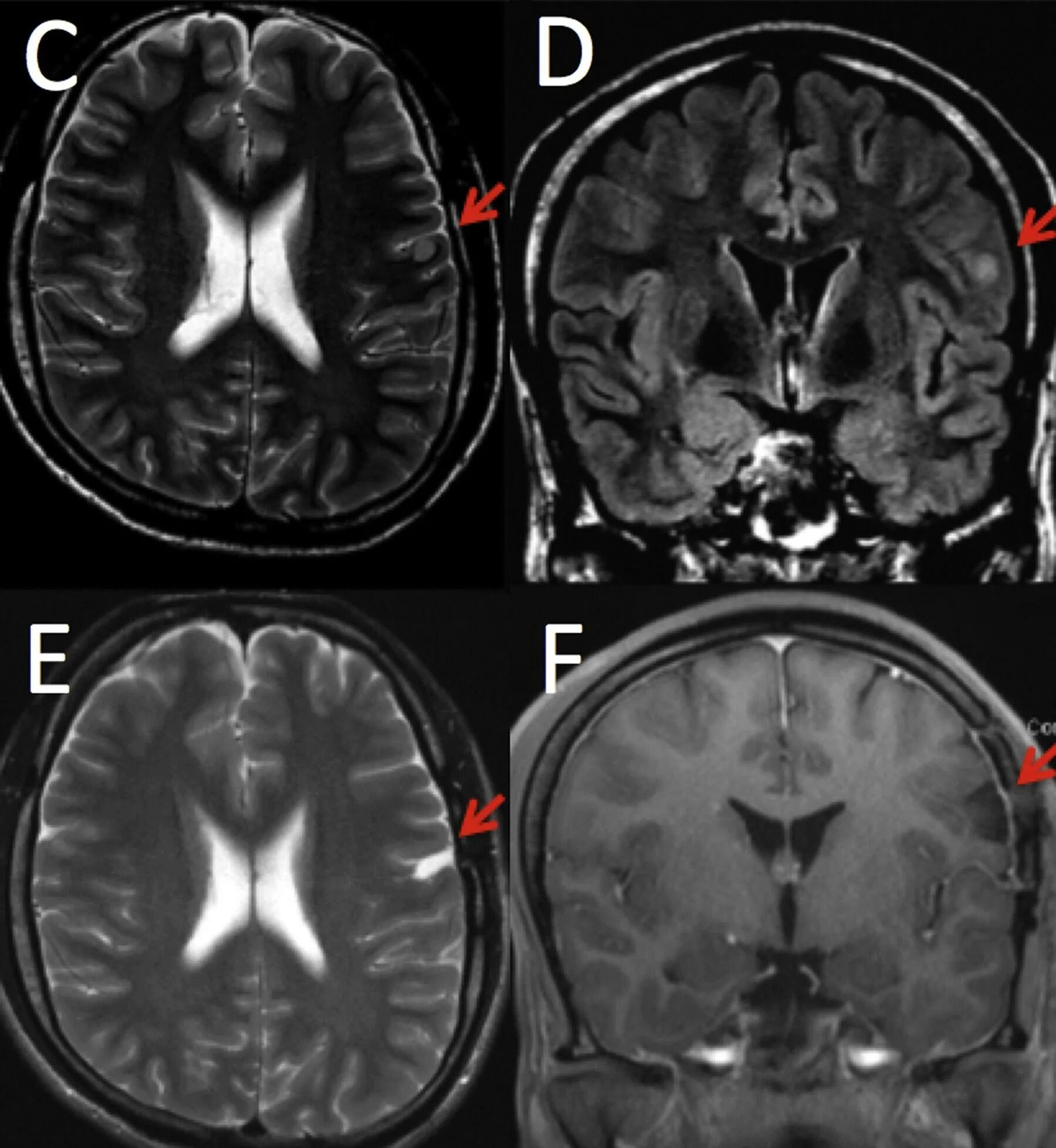 Мрт мозга опасно. Мрт головного мозга Axial норма. MRI головного мозга. Кт головы. Мрт снимки.