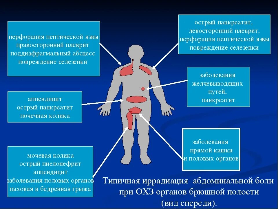 Боль вызванная острыми заболеваниями. Абдоминальная боль. Локализация боли в брюшной полости. Травмы органов брюшной полости. Острая абдоминальная боль.