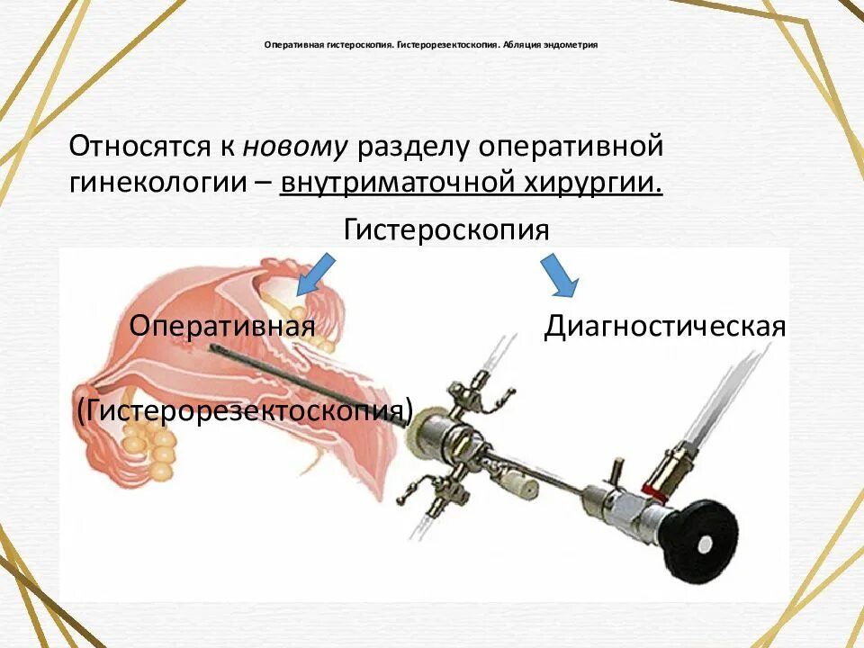 Гистерорезектоскопия полипэктомия. Гистероскопия с полипэктомией. Гистероскопическая полипэктомия. Гистероскопия с полипэктомией. Гистероскопия с полипэктомией.