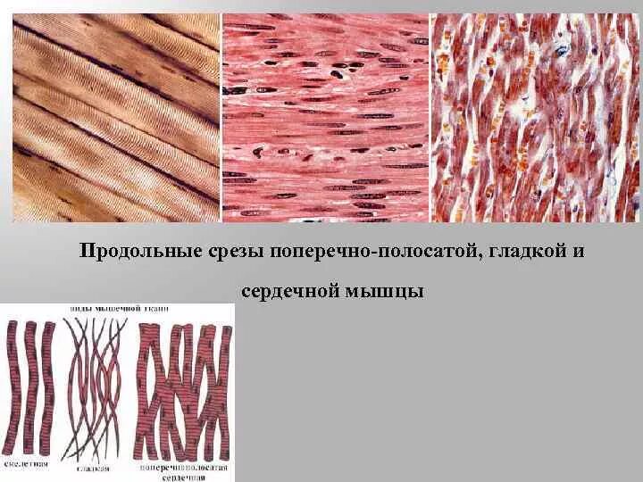 Мышечная ткань характеризуется. Поперечно полосатая мышечная ткань на поперечном и продольном срезе. Скелетная поперечнополосатая мышечная ткангладкая. Скелетная поперечно-полосатая мышечная ткань продольный срез. Скелетная сердечная и гладкая мышечная ткань.