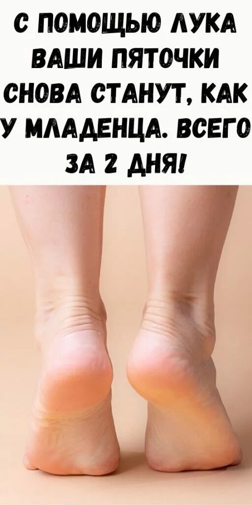 Как сделать пятки мягкими и гладкими