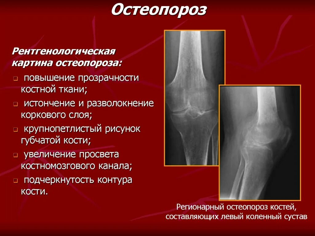 Костной ткани для улучшения