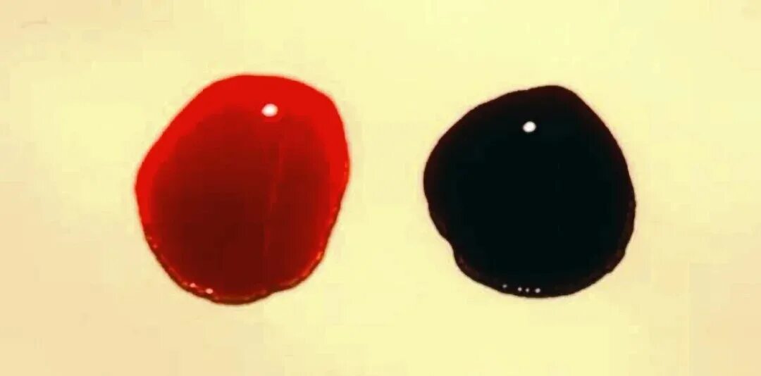 Какого цвета артериальная. Артериальная и венозная кровь. Типы крови человека венозная артериальная и венозная. Алая кровь артериальная или венозная. Какого цвета артериальная.