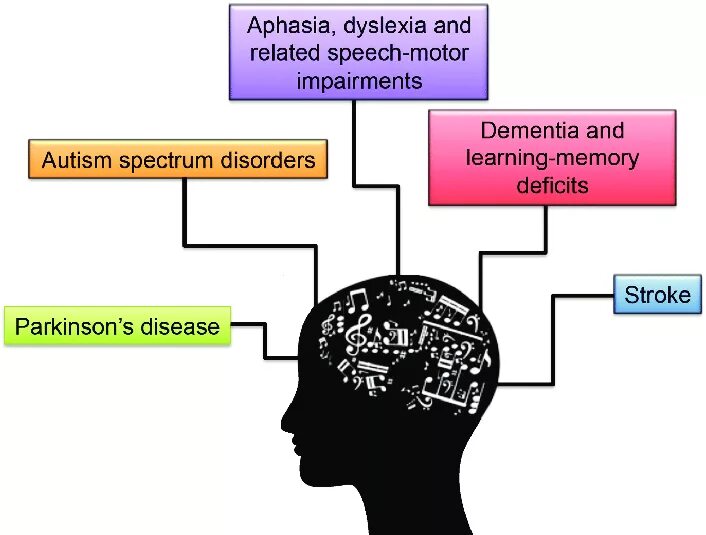 Brain disorder. Neurological Disorders. Functional Disorders in Neurology. Motor Speech Disorders. Symptoms of neurological Disorders.