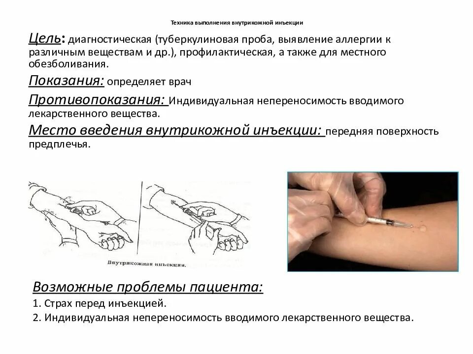 Алгоритм инъекции внутрикожной инъекции. Введение иглы при внутрикожной инъекции. Угол введения иглы при внутрикожной инъекции. Внутрикожное Введение лекарственных средств угол введения.