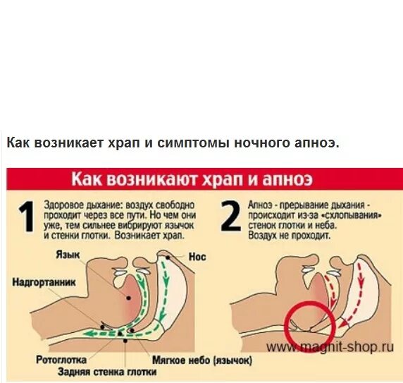 Почему появляется храп