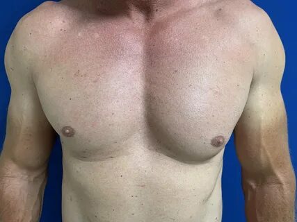 Wrinkled Areola Tit.
