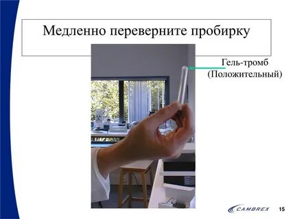 Лал теста