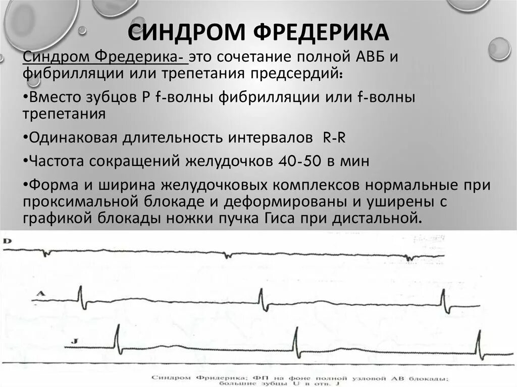 Блокада код по мкб 10