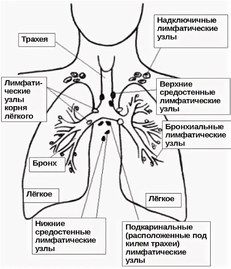 Увеличение лимфоузлов в легких причины. Внутригрудные лимфатические узлы схема. Схема лимфатических узлов легких. Лимфатические узлы средостения схема. Расположение внутригрудных лимфоузлов схема.