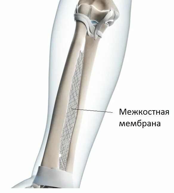 Соединения локтевой кости. Локтевой сустав межкостная мембрана. Межкостная мембрана соединяет кости. Мембрана между берцовыми костями. Дистальный Луче локтевой сустав.