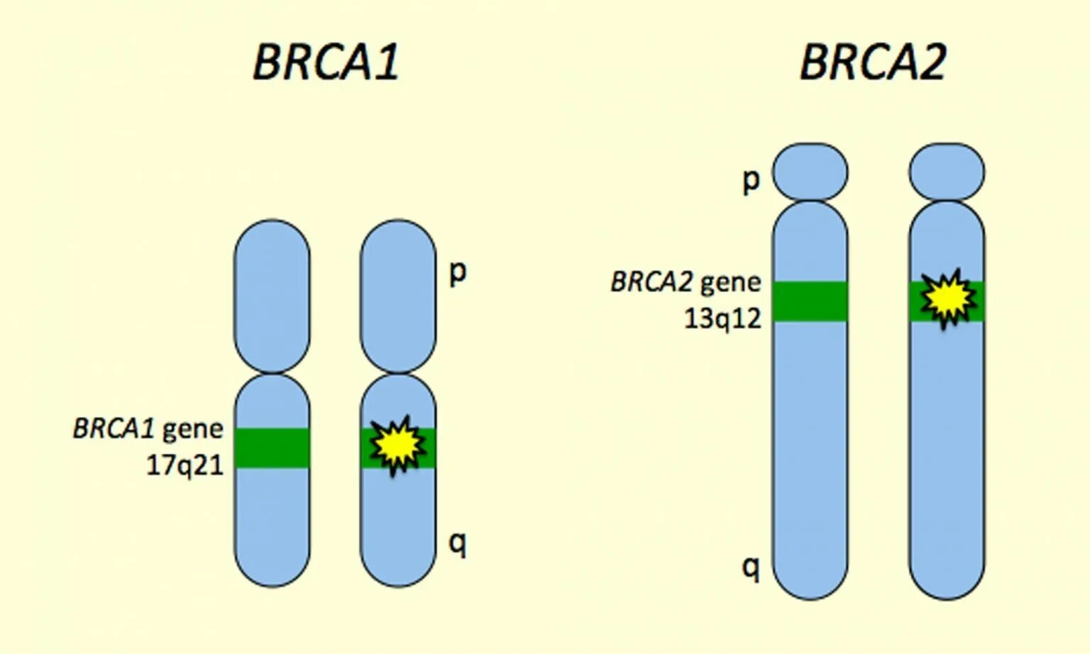 Геном железу. Мутация brca1/2. Brca мутация. Мутации генов brca 1/2. Мутация генов brca1 и brca2.