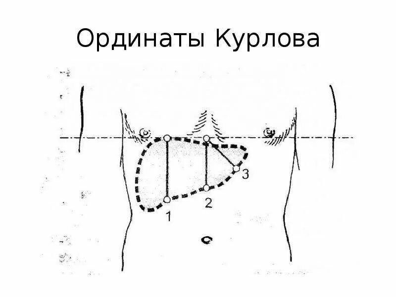 Нижняя граница печени. Перкуссия печени границы в норме. Пальпация печени по курлову. Перкуссия печени Курлова. Пальпация и перкуссия печени по курлову у детей.