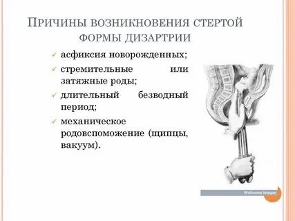 Дизартрия структура
