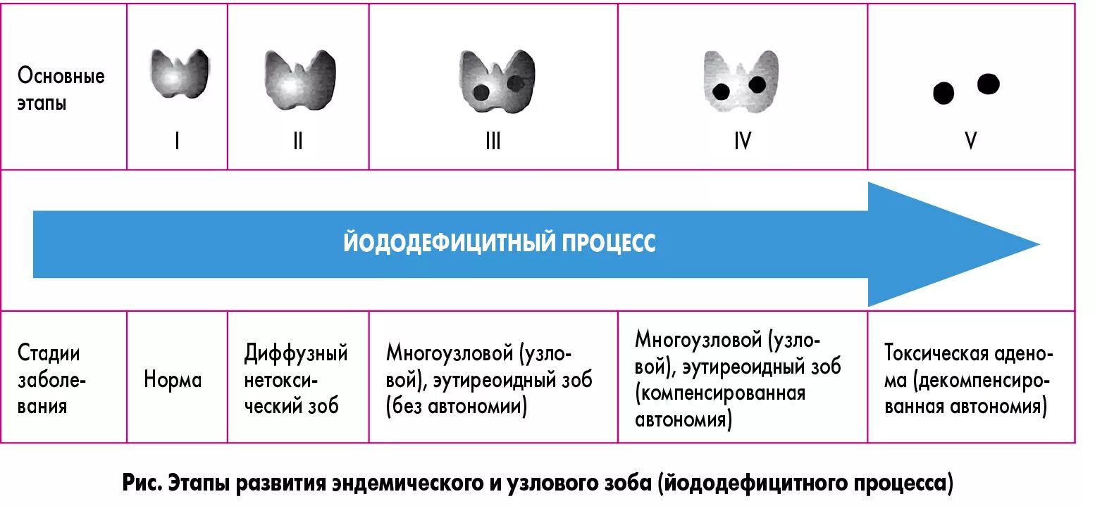 Эутиреоидный зоб классификация. . Зоб. Этиология и патогенез. Классификация. Узловой токсический зоб патогенез. Узловой зоб щитовидной железы классификация. Многоузловой зоб степени