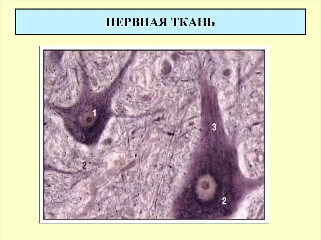 Нейрофибриллы в нервных клетках спинного мозга препарат. Нейрофибриллы препарат гистология. Нейрофибриллы в нервных клетках препарат гистология. Нейрон гистология препарат.