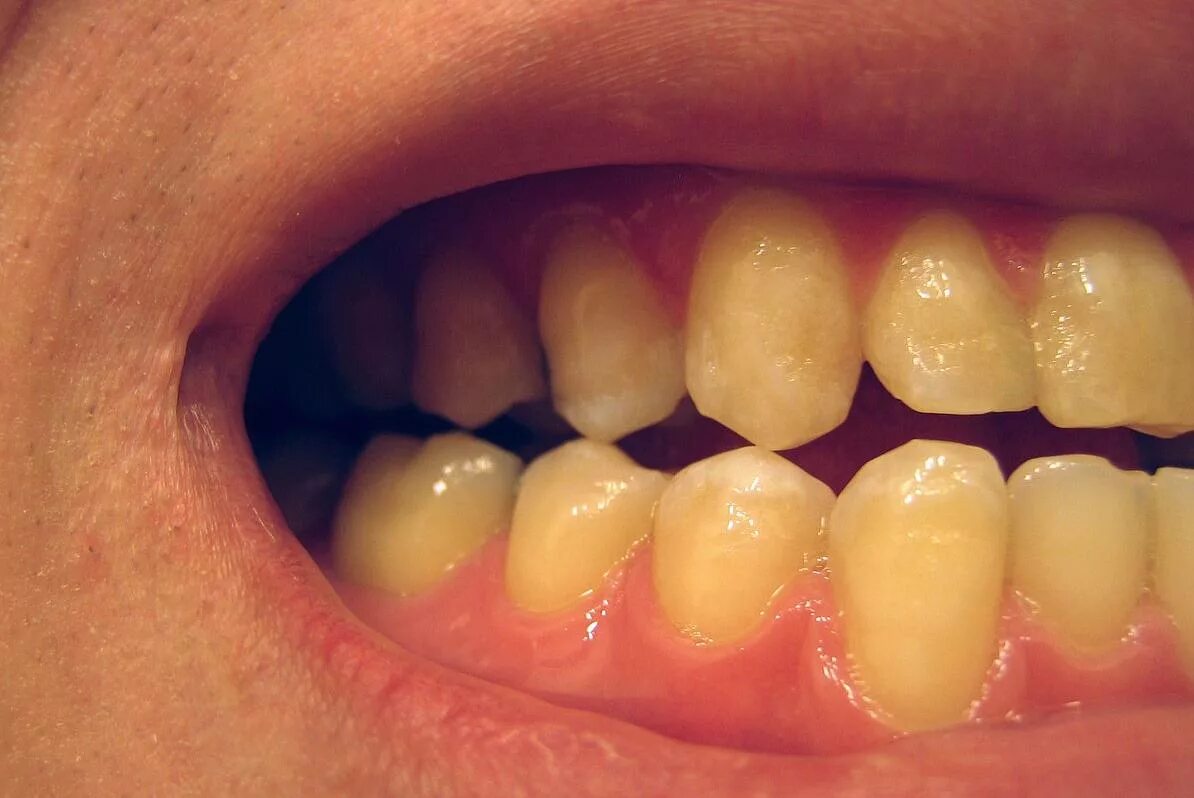 Зубы без проблем. Зубы без проблем. Улыбка с зубами. Стоматологическое зеркало и зубы. Зубы мужские.