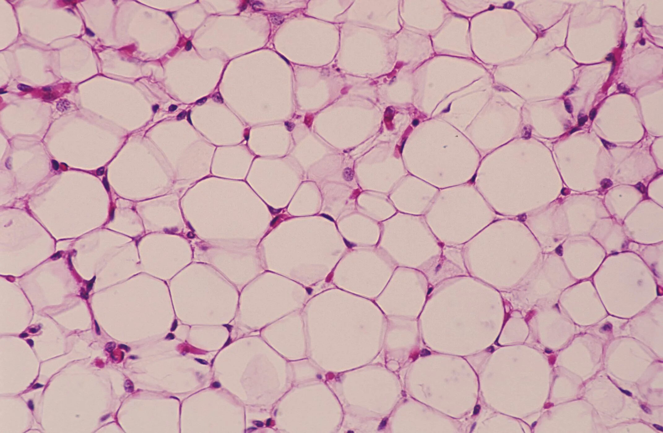 Адипоциты жировой ткани. Жировая ткань микроскопия. Белая жировая ткань под микроскопом. Адипоциты гистология.