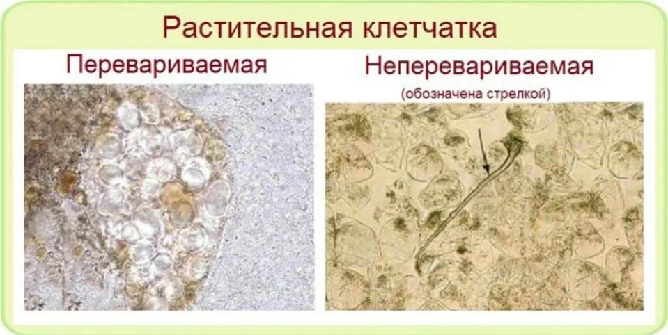 Растительная клетчатка в копрограмме