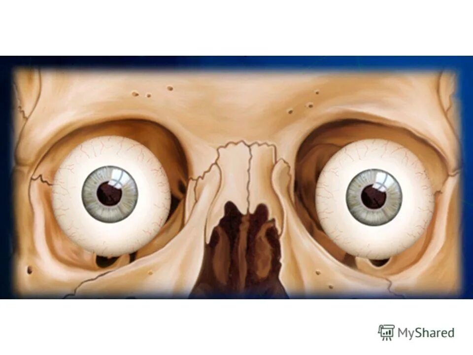 Глазница черепа анатомия стенки. Глазница видео. Надкостница периорбитальной зоны. Анатомия глазного яблока и глазницы. Расположение глаза в глазнице черепа.